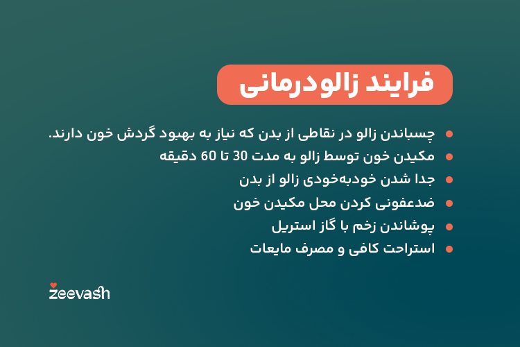 فرایند زالودرمانی